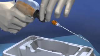 Arrow® OnControl® Bone Marrow Aspiration amp Biopsy Procedure  MC 001172 [upl. by Chiarra]