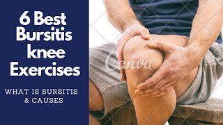 6 Best Bursitis Knee Pain Exercises amp Physiotherapy [upl. by Birkett202]