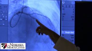 When Is A Heart Stent Needed [upl. by Kyd107]