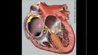 AVRNT atrioventricular reentry tachycardia  causes pathophysiology treatment [upl. by Ridley795]