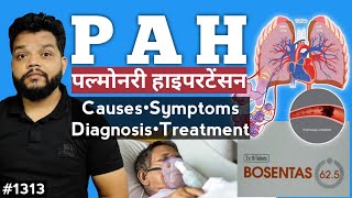 Pulmonary Hypertension  CausesSymptomsDiagnosis amp Treatment In Hindi [upl. by Esylla]