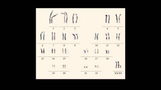 Karyotype notations [upl. by Tupler404]