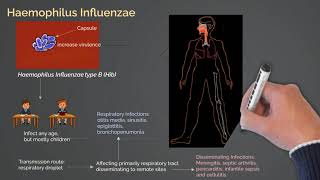 Haemophilus Influenzae Infections [upl. by Colburn]