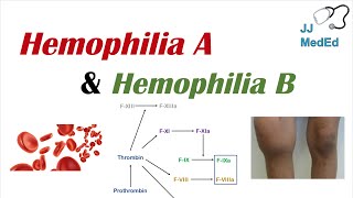 Hemophilia A vs Hemophilia B  Genetics Symptoms and Treatment [upl. by Sutphin]