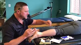 Iontophoresis in Physical Therapy [upl. by Ahseenat]