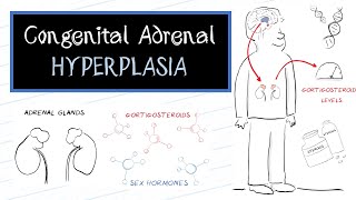 What is Congenital Adrenal Hyperplasia CAH [upl. by Martsen]