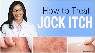 Jock Itch Treatment Prevention Causes and Home Care Tips [upl. by Sharma41]