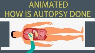 Autopsy Detailed animation on how is Autopsy done [upl. by Scrope]