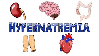 An Approach to Hypernatremia  Hypernatremia Diagnostic Algorithm  Hypernatremia Causes MADE EASY [upl. by Victoria270]