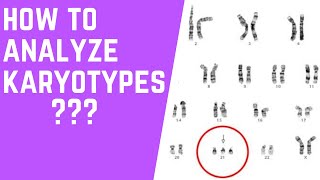 How to Analyze Karyotypes 101 [upl. by Doherty]