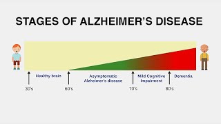 Diagnosing Alzheimer’s Disease [upl. by Richers]