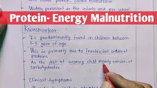 Protein  Energy Malnutrition  Kwashiorkor  Marasmus  Biochemistry [upl. by Hollinger]