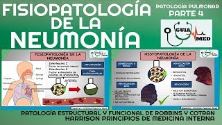 NEUMONÍA ADQUIRIDA EN LA COMUNIDAD FISIOPATOLOGÍA PARTE 1 GuiaMed [upl. by Cohe]