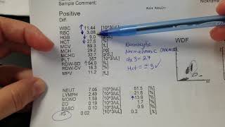 Hematology How to interpret automated Complete Blood Count CBC results [upl. by Farrington525]