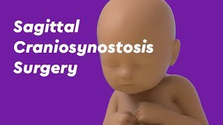 Craniosynostosis  FAQ with Pediatric Neurosurgeon Eric Jackson MD [upl. by Aihseyn]