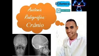 Anatomia Radiográfica do Crânio [upl. by Ludlow448]