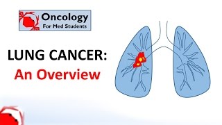 Lung Cancer An Overview [upl. by Assiar588]