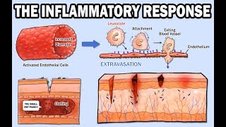 THE INFLAMMATORY RESPONSE [upl. by Dominica523]