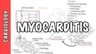 Myocarditis  causes pathophysiology investigation and treatment [upl. by Esinert963]