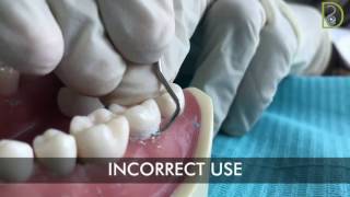 Dentiscope  How to use supragingival scalers [upl. by Ennayk]