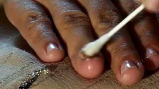 How to Cure Nail Fungus [upl. by Ahsiral]