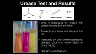 Microbiology Urea Test [upl. by Cosma]