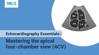 Echocardiography Essentials Mastering the apical fourchamber view 4CV [upl. by Aikar101]