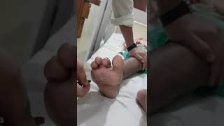 Upgoing plantar reflex positive Babinskis test [upl. by Musihc]