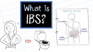 How to Manage Irritable Bowel Syndrome IBS Symptoms  Diagnosis  Treatment [upl. by Hairahcez]