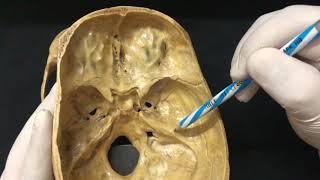 Skull Osteology  Cranial Cavity Anatomy [upl. by Lily]