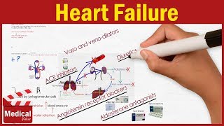 Living with Heart Failure  A Guide for Patients [upl. by Sydney]