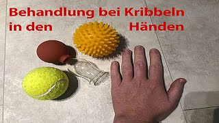 Behandlung bei Kribbeln in den Händen [upl. by Arin]