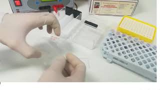 Hemoglobin electrophoresis procedure [upl. by Arihday]