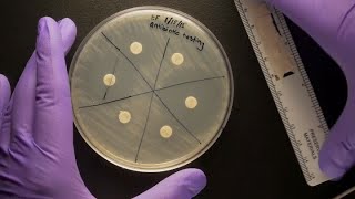 ID Laboratory Videos Antibiotic susceptibility testing [upl. by Alguire]