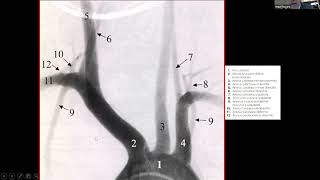 Inferior Mesenteric ArteryIMA  Abdominal Aorta Branch  Hindgut Blood Supply [upl. by Salisbarry]