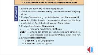 EKGQuickie Breitkomplextachykardie Tipps und Tricks [upl. by Burnie]