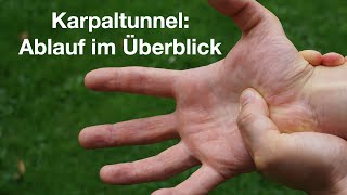 Karpaltunnelsyndrom  Kribbeln in den Fingern Knackpunkt Hand [upl. by Pillihpnhoj]