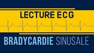 Interprétation ECG  Bradycardie Sinusale [upl. by Grae]