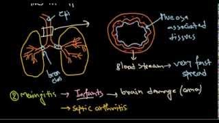 Haemophilus influenzae infection [upl. by Eiramrebma]