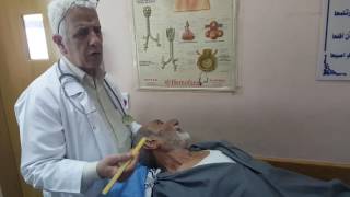 Clinical examination by Dr Hamzah [upl. by Ecidnac]