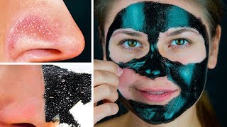 11 Masques Pour le Visage Faciles Avec 2 Ingrédients à Préparer en Une Minute [upl. by Ahsaetal]