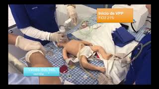 REANIMACION NEONATAL ALGORITMO COMPLETO [upl. by Eeroc]