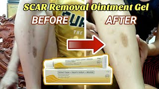 PANTANGGAL NG OLD SCARPEKLAT  Contractubex Ointment Gel REVIEW Explained [upl. by Harwell]