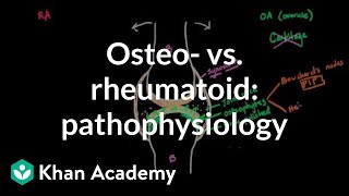 Osteoarthritis vs rheumatoid arthritis pathophysiology  NCLEXRN  Khan Academy [upl. by Brett]