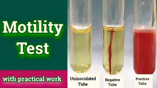 Motility test  Microbiology Microbial Biochemical test [upl. by Eisserc]