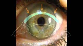 Cornea 1 A Remarkable Structure [upl. by Atwood]