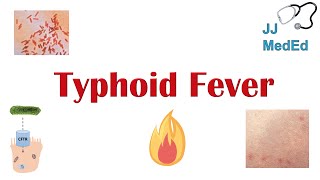 Typhoid Fever Pathogenesis vectors bacteria Symptoms Diagnosis Treatment Vaccine [upl. by Goulet]