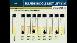 Sulfide Indole Motility SIM medium test [upl. by Harrod]