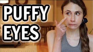 How to get rid of puffy eyes Dr Dray [upl. by Aerdnuahs]