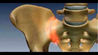 Where is the Sacroiliac Joint Anatomy of the Sacroiliac Joint [upl. by Servais577]